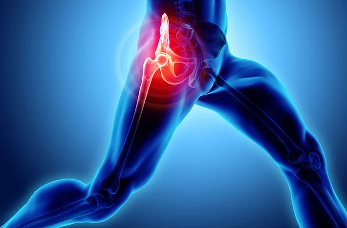Hip Pain therapy at Seva Physical Therapy