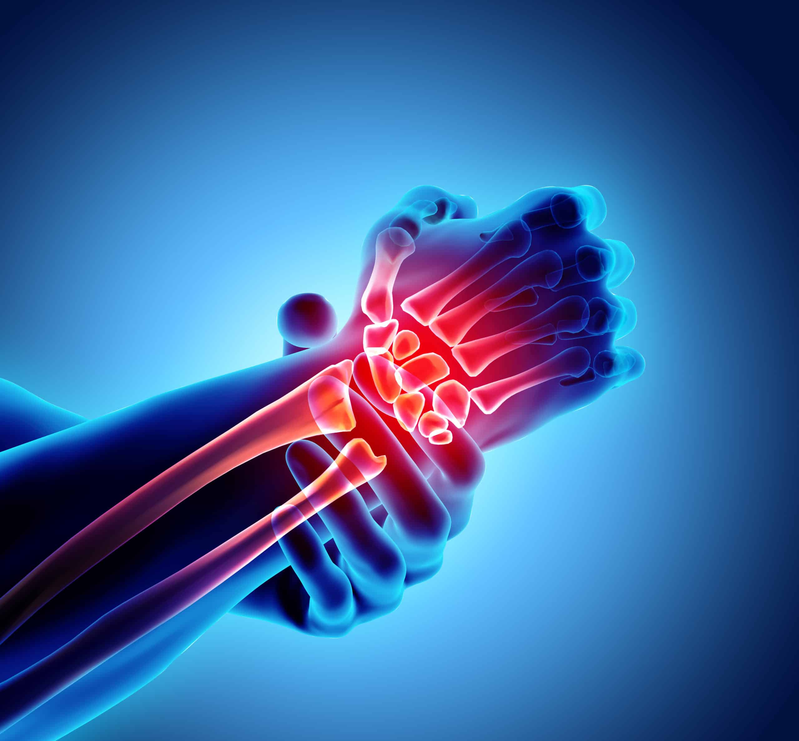 Elbow, Wrist & Hand therapy at Seva Physical Therapy